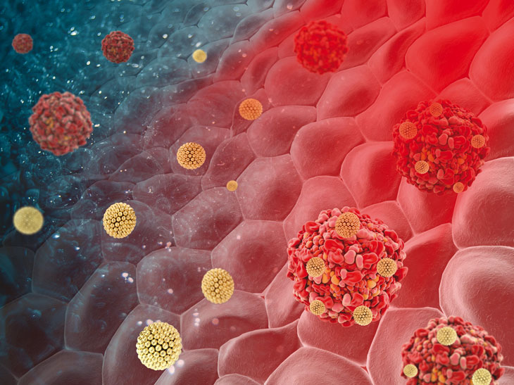 A 3D conceptualisation of the Human Papillomavirus (HPV) showing large and abnormal red cell structures