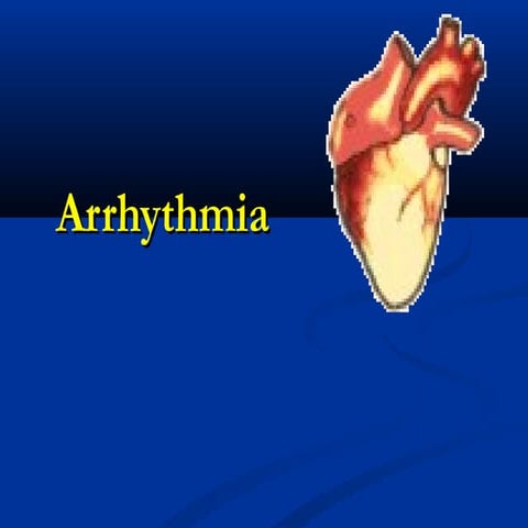 Arrhythmia. Irregular Heartbeat