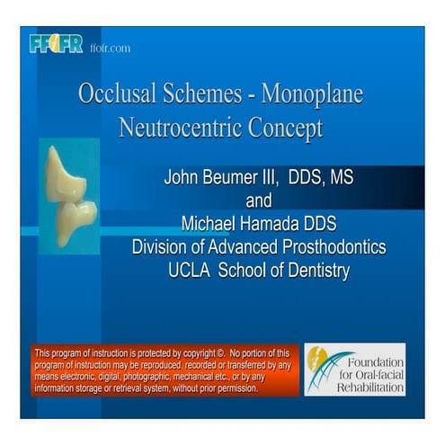 20.(new)occlusal schemes monoplane-neutrocentric concept