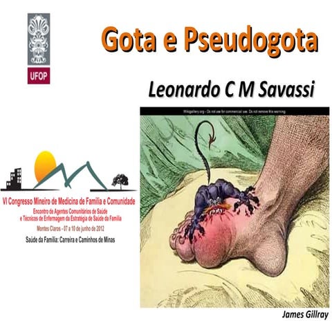 2012 gota e pseudogota