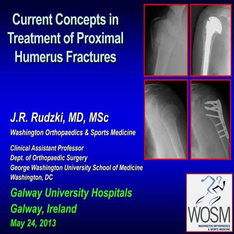 Current Concepts in Treatment of Proximal Humerus Fractures 