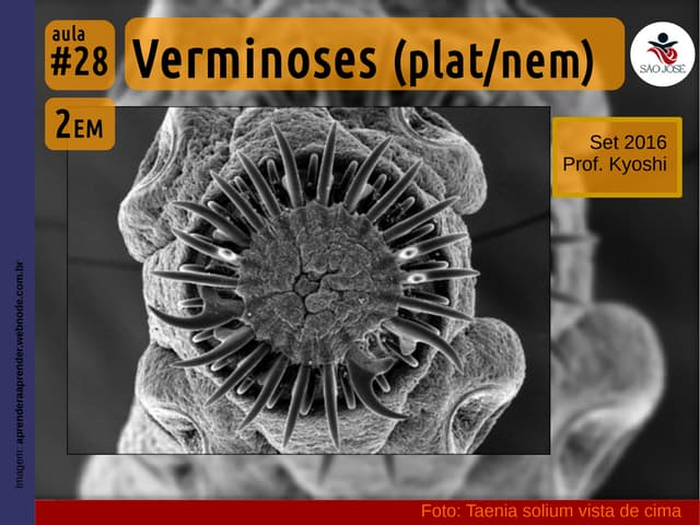 2EM #28 Verminoses