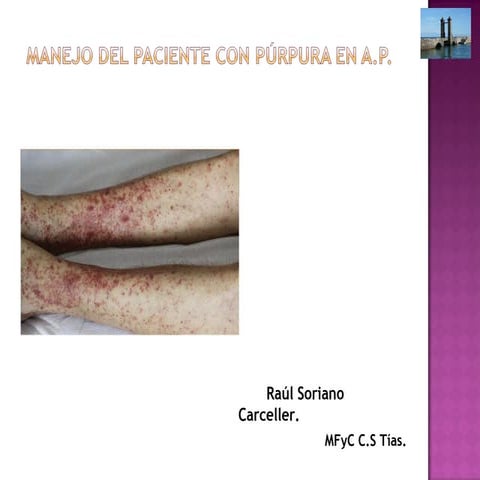 3. manejo del paciente con púrpura en a
