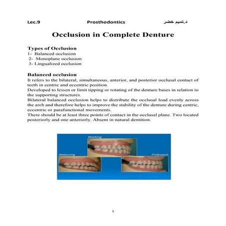 occlusion in complete denture review .pdf