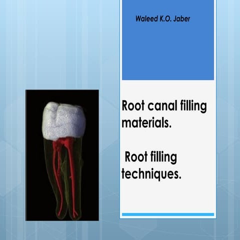 5 root canal filling materials