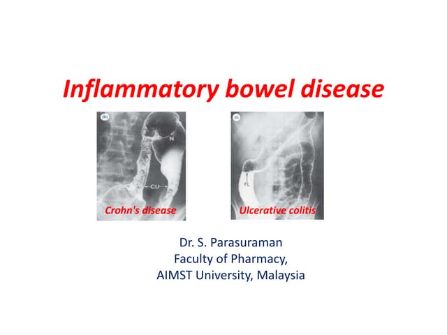 Inflammatory bowel disease