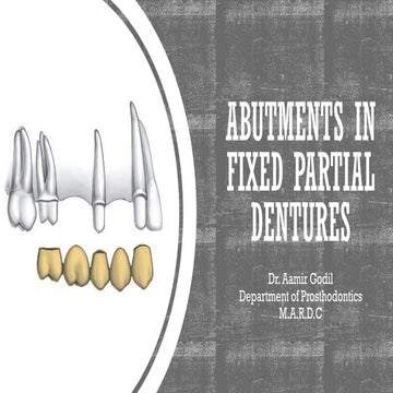 ABUTMENTS IN FIXED PARTIAL DENTURE