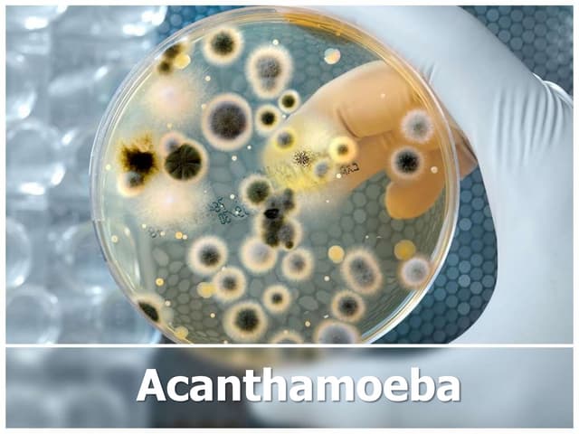 Acanthamoeba