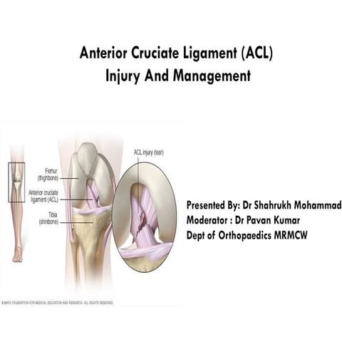 acl-copy-140820124640-phpapp01.pptxxxxxx