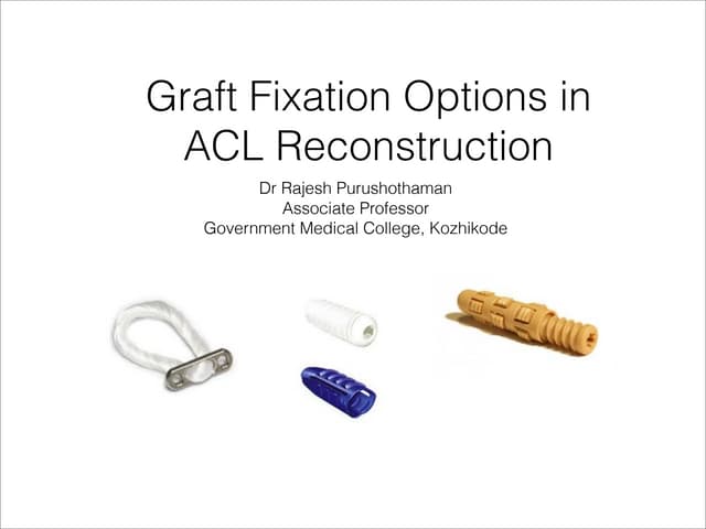 Acl graft fixation options