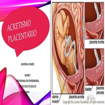 ACRETISMO PLACENTARIO