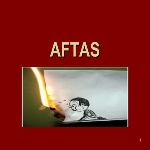 Aftas