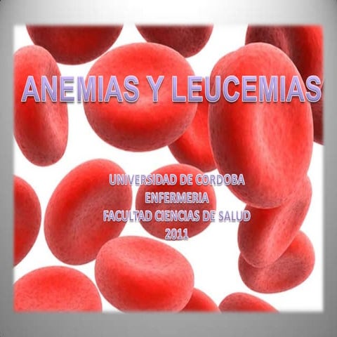 Anemias y leucemias 