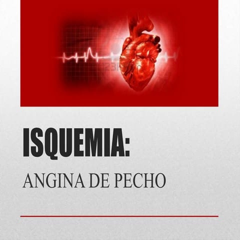 Angina de pecho