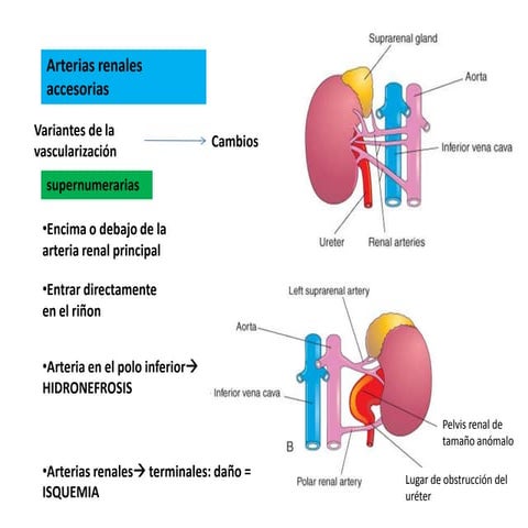 Anomalias CongéNitas de vías urinarias