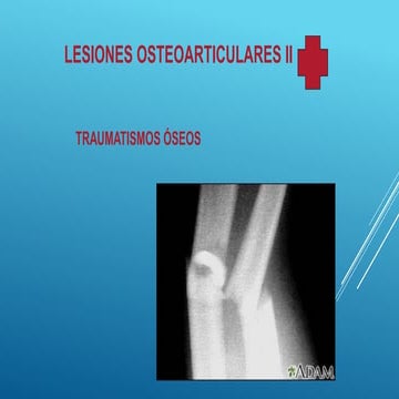 Articulaciones oseas primeros auxilio unidad de bienestar universitario