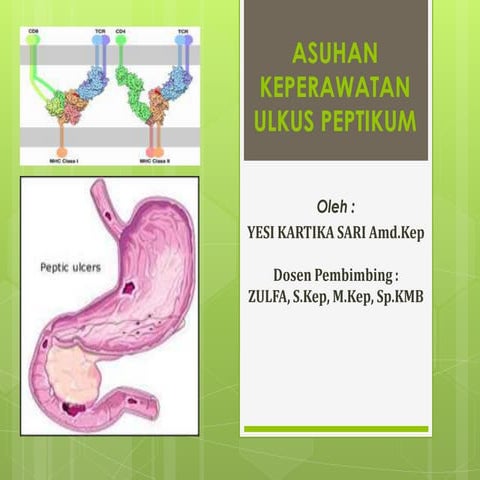 Asuhan keperawatan ulkus peptikum.....