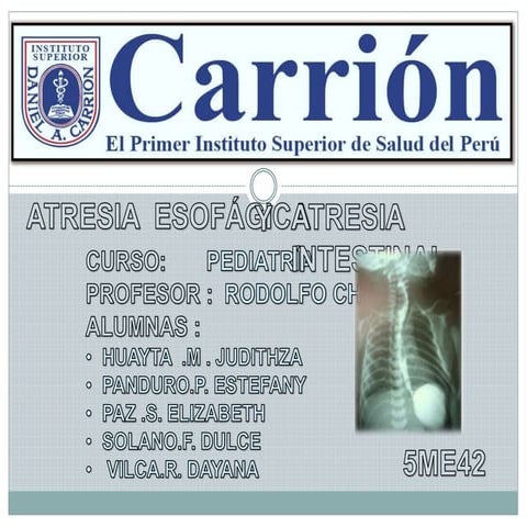 Atresia esofagica , intestinal RN