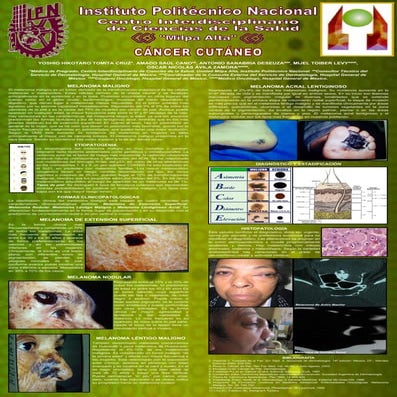 CANCER CUTANEO: MELANOMA MALIGNO, Revisión de la Literatura.