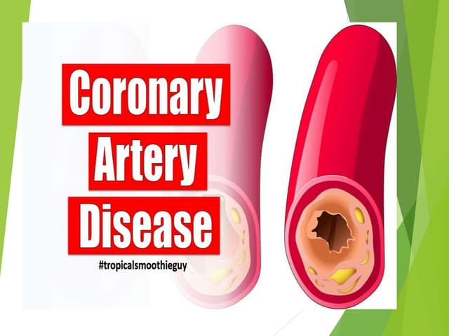 coronary artery disease