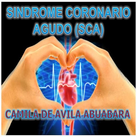 Sindrome Coronario Agudo