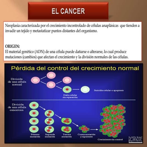 Cancer cuello uterino