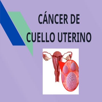 CANCER DE CERVIX (2).pptxxxxxxxxxxxxxxxxxxxxxxxxxxxxxxxx