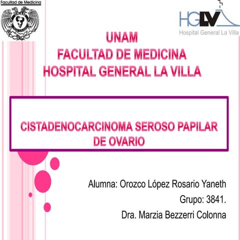 CISTADENOCARCINOMA SEROSO PAPILAR DE OVARIO