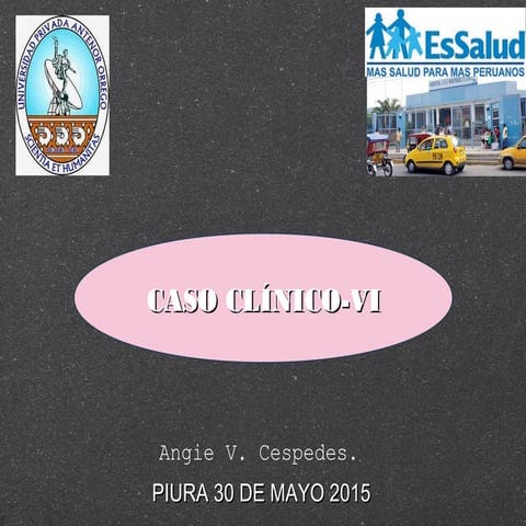 Caso 4 -2 Persistencia de Uraco  