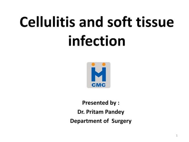 soft tissue infection