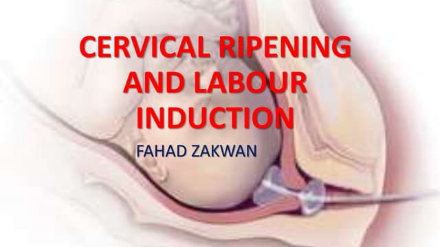 Cervical ripening