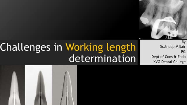 Challenges in working length determination