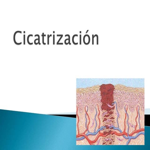 Cicatrización