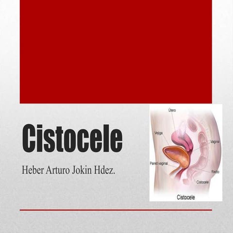 Cistocele