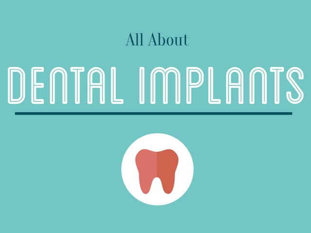 All About Dental Implants