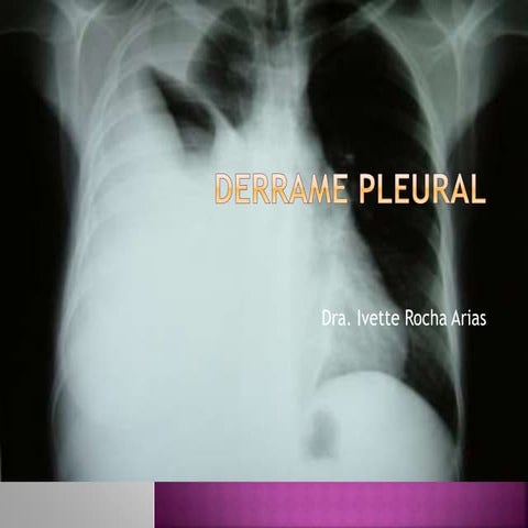 Clase 7 Derrame Pleural