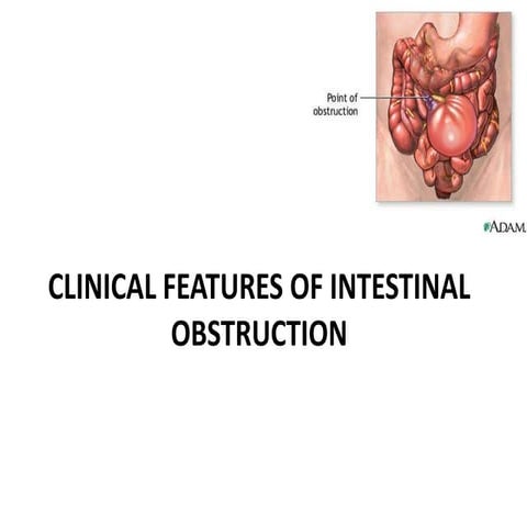 Clinical features of intestinal obstruction