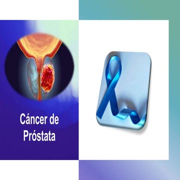 Cáncer de Próstata.pptx