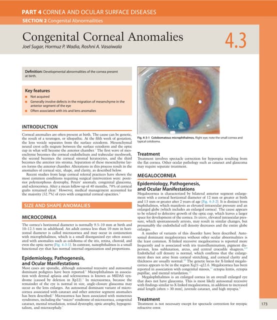 Congenital corneal anomalies