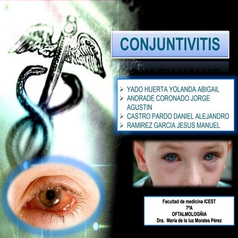 Conjuntivitis