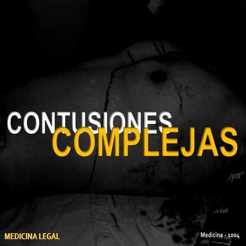 Contusiones complejas