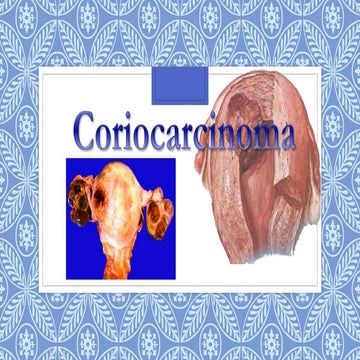 Coriocarcinoma