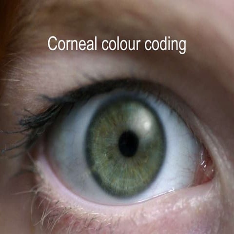Eye colour coding