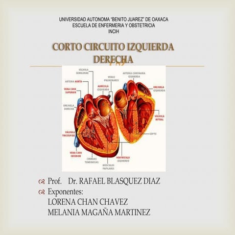 Corto circuito izquierda derecha list