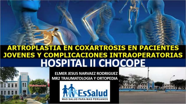 protesis de cadera y sus complicaciones