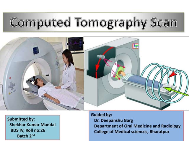 Ct scan final (2)