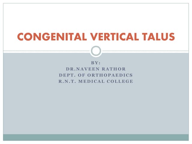 Congenital vertical talus BY DR.NAVEEN RATHOR