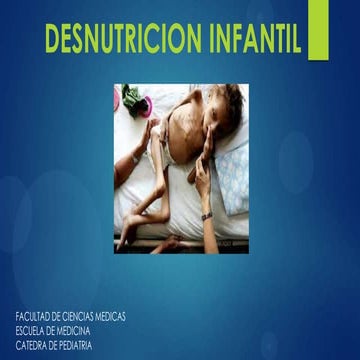 Desnutricion (manuel guevara)