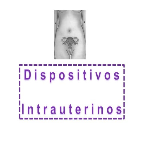 Dispositivos intrauterinos