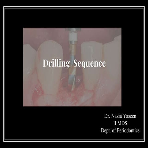 Drilling sequence in implants